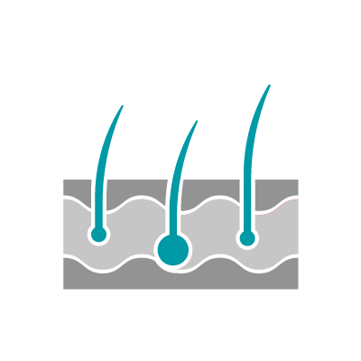 Un diagramma che mostra tre follicoli piliferi color verde acqua di dimensioni variabili, immersi in uno strato di tessuto cutaneo grigio.