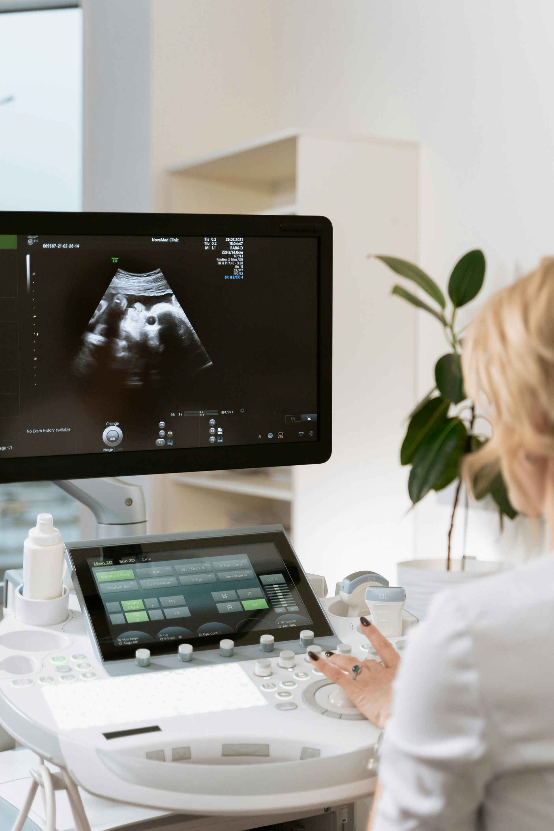 Un operatore sanitario utilizza un apparecchio a ultrasuoni, visualizzando l'immagine sul monitor in un ambiente clinico.