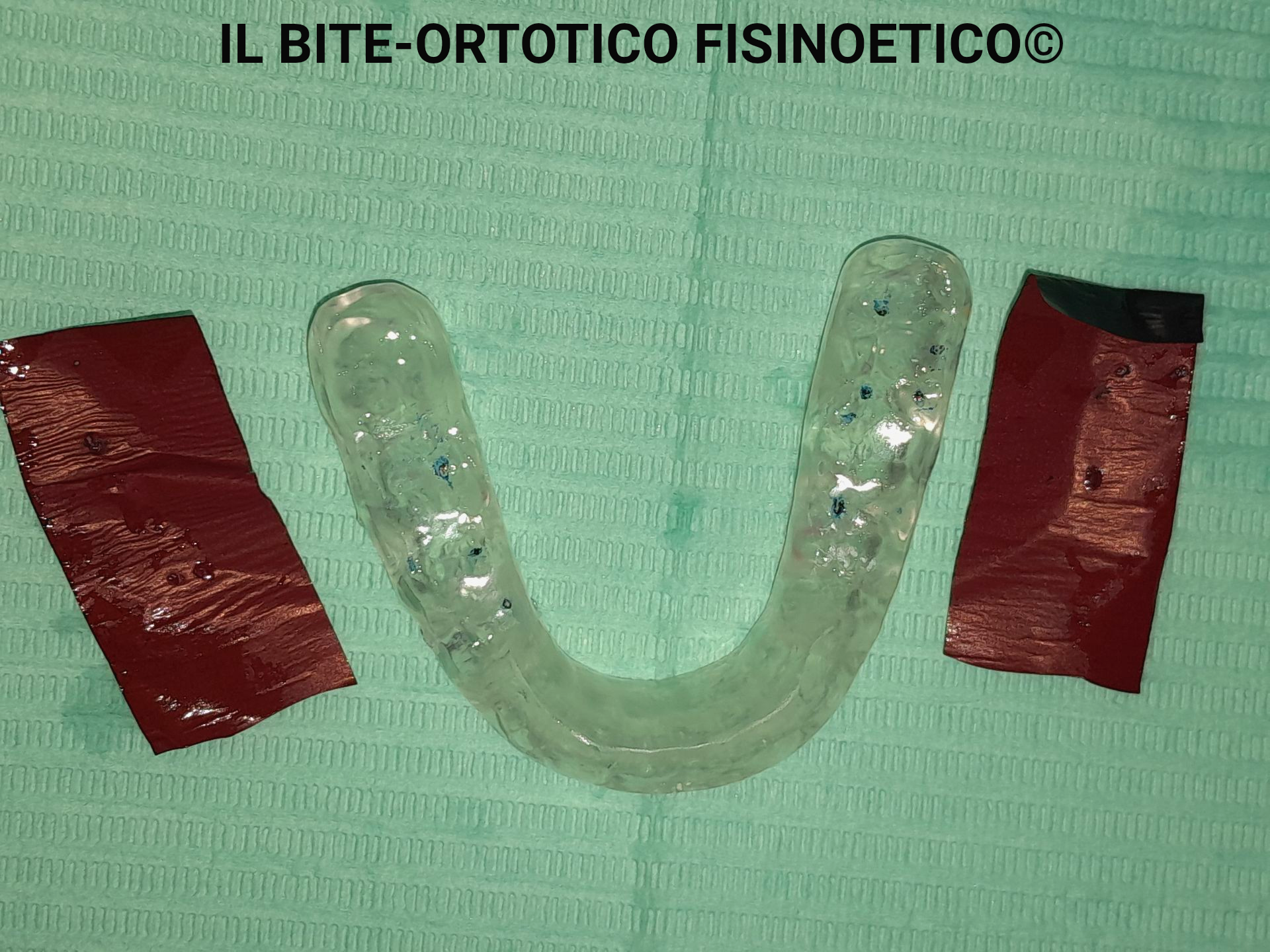  IL BITE-ORTOTICO FISINOETICO©