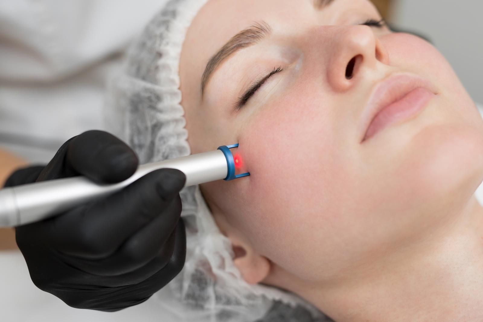 A woman is getting a laser treatment on her face.