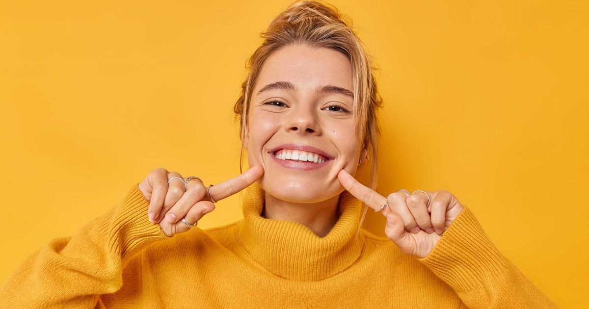 dental veneers