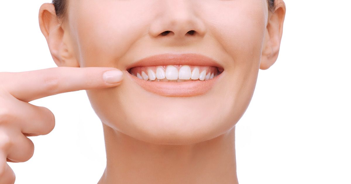 teeth whitening results