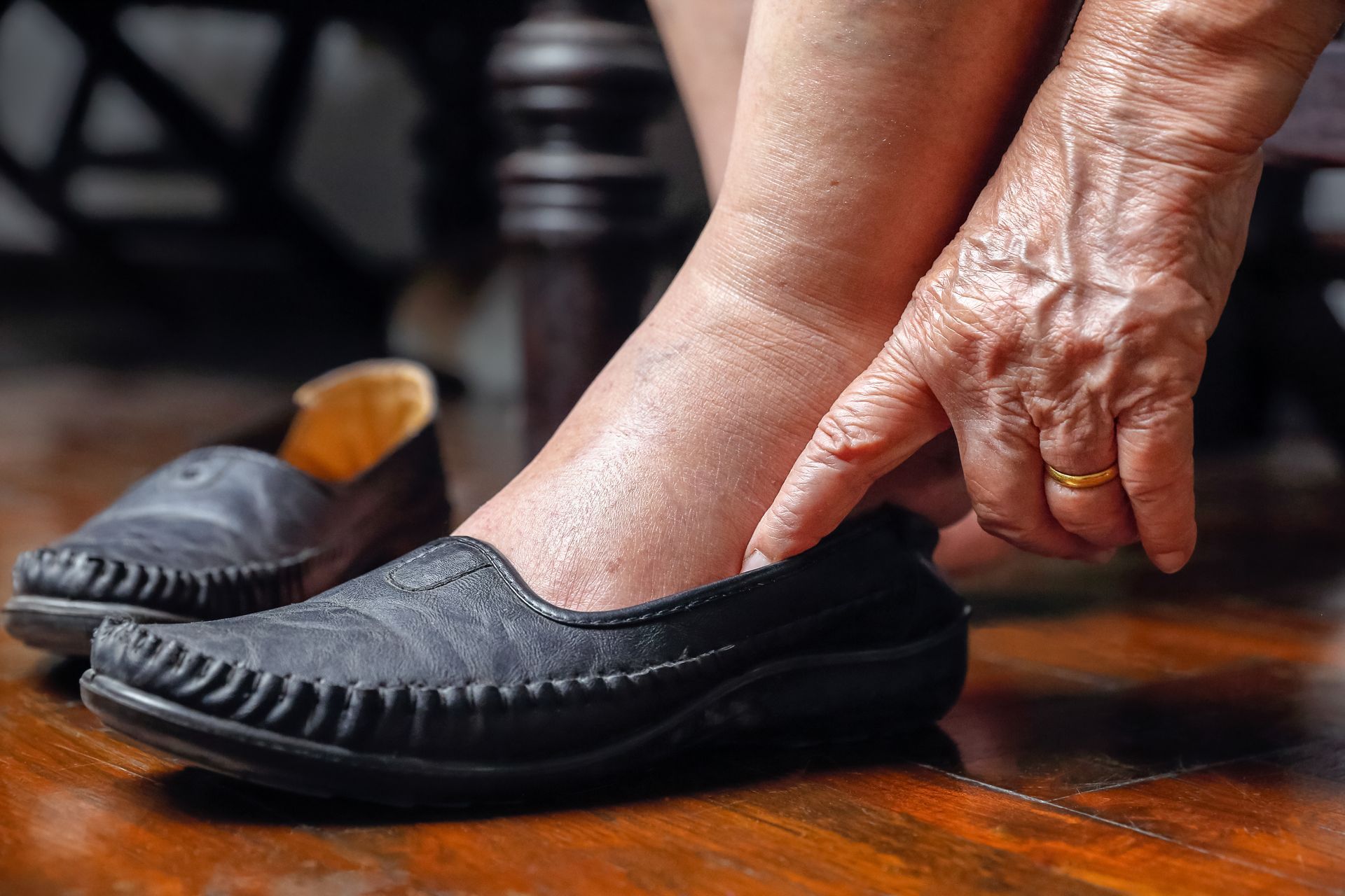 Swollen ankle being touched, next to black shoe, on wood surface.