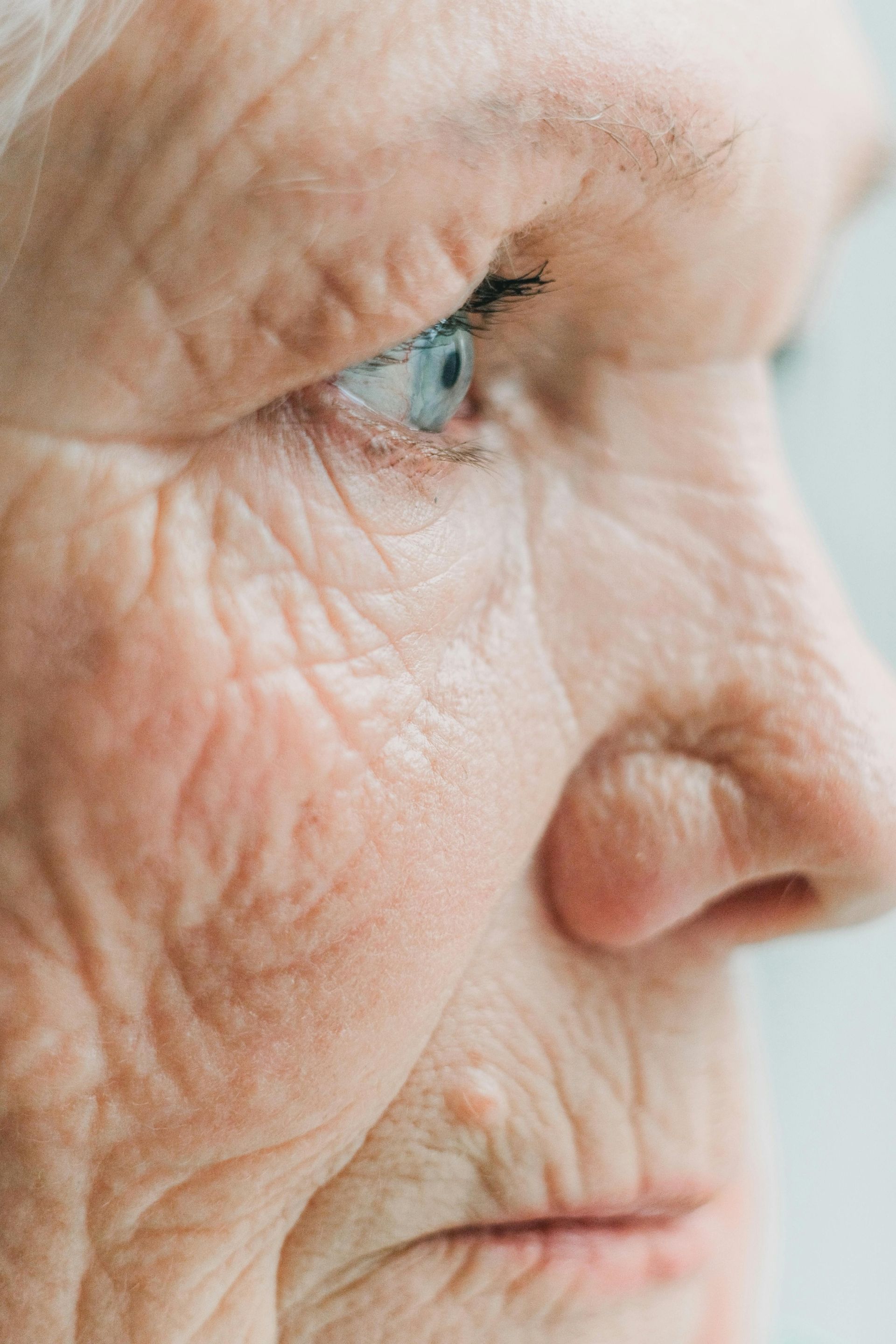 Close-up of a person's profile; visible wrinkles and pale blue eye.