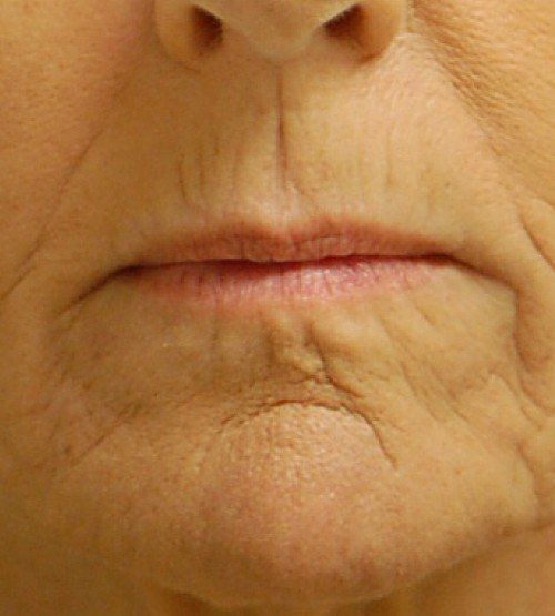 close up of mouth wrinkles