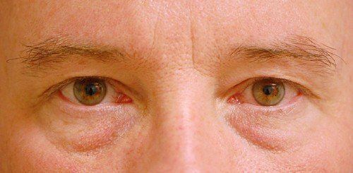close up of eyes