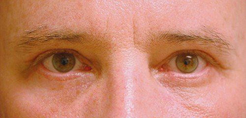 close up of eyes