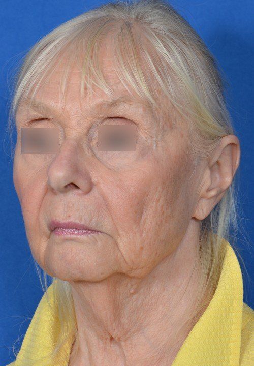 old womans face