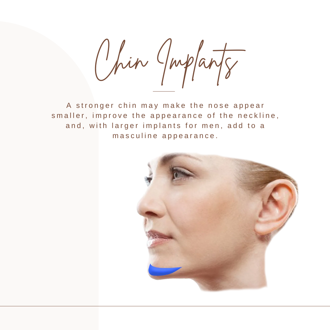 chin implants graphic