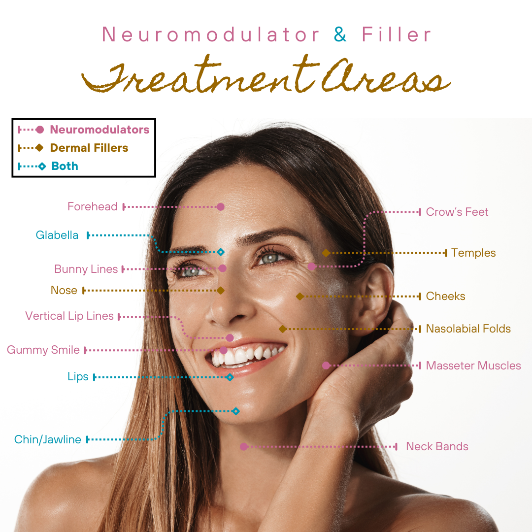 neuromodulator and filler treatment areas