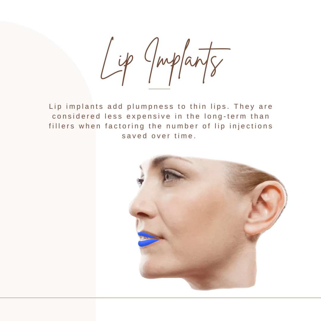 lip implants graphic