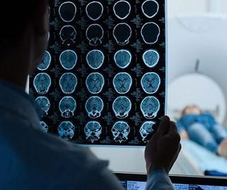 Un hombre está mirando una radiografía del cerebro de una persona.