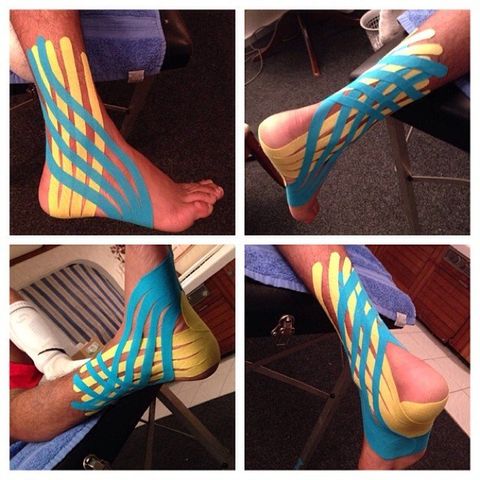 Four views of a foot wrapped in blue and yellow kinesiology tape on the ankle and arch.