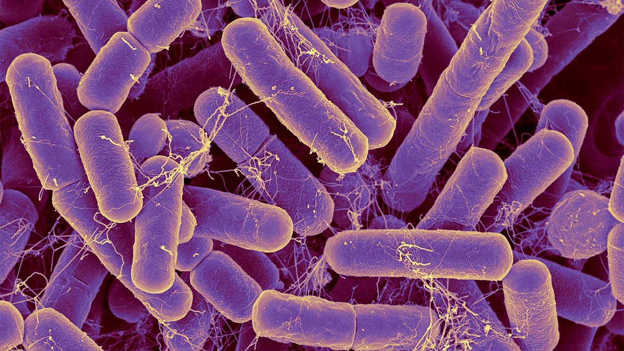 A close up of a bunch of purple bacteria under a microscope.