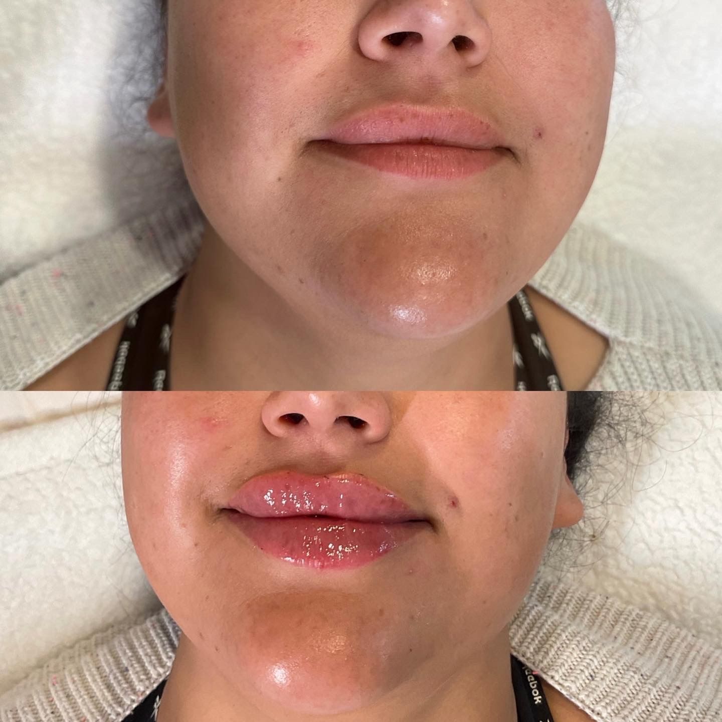 A before and after picture of a woman 's face