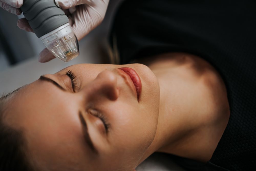 A person lying down receiving a microneedling facial treatment with a handheld device.