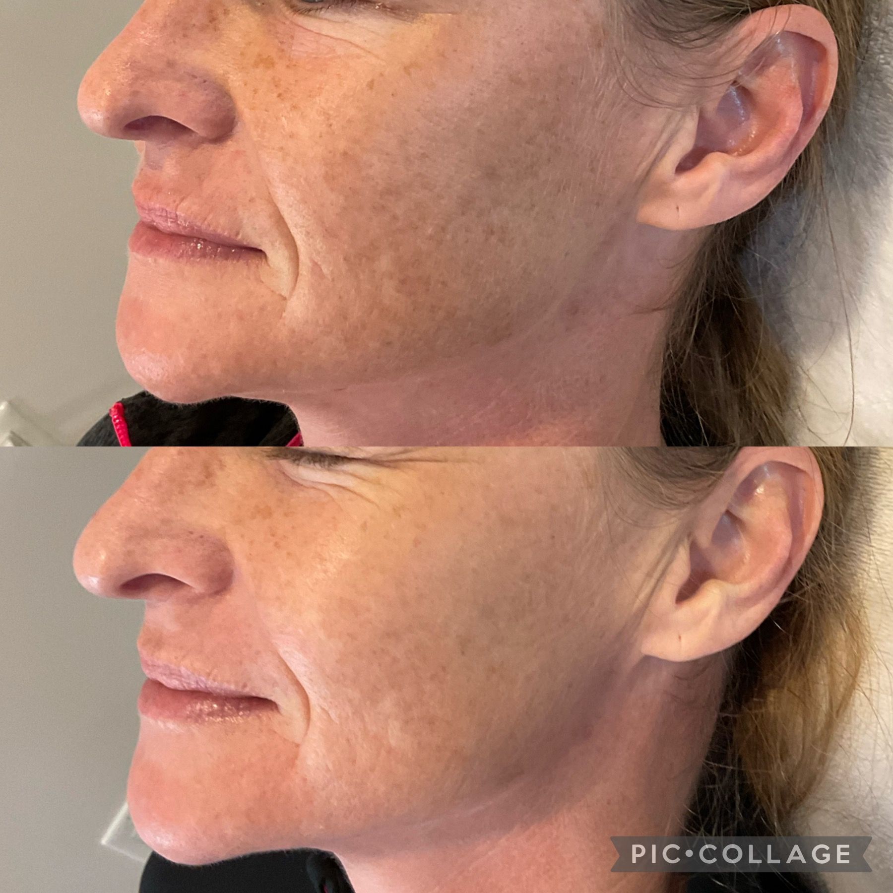 A before and after photo of a woman 's face.