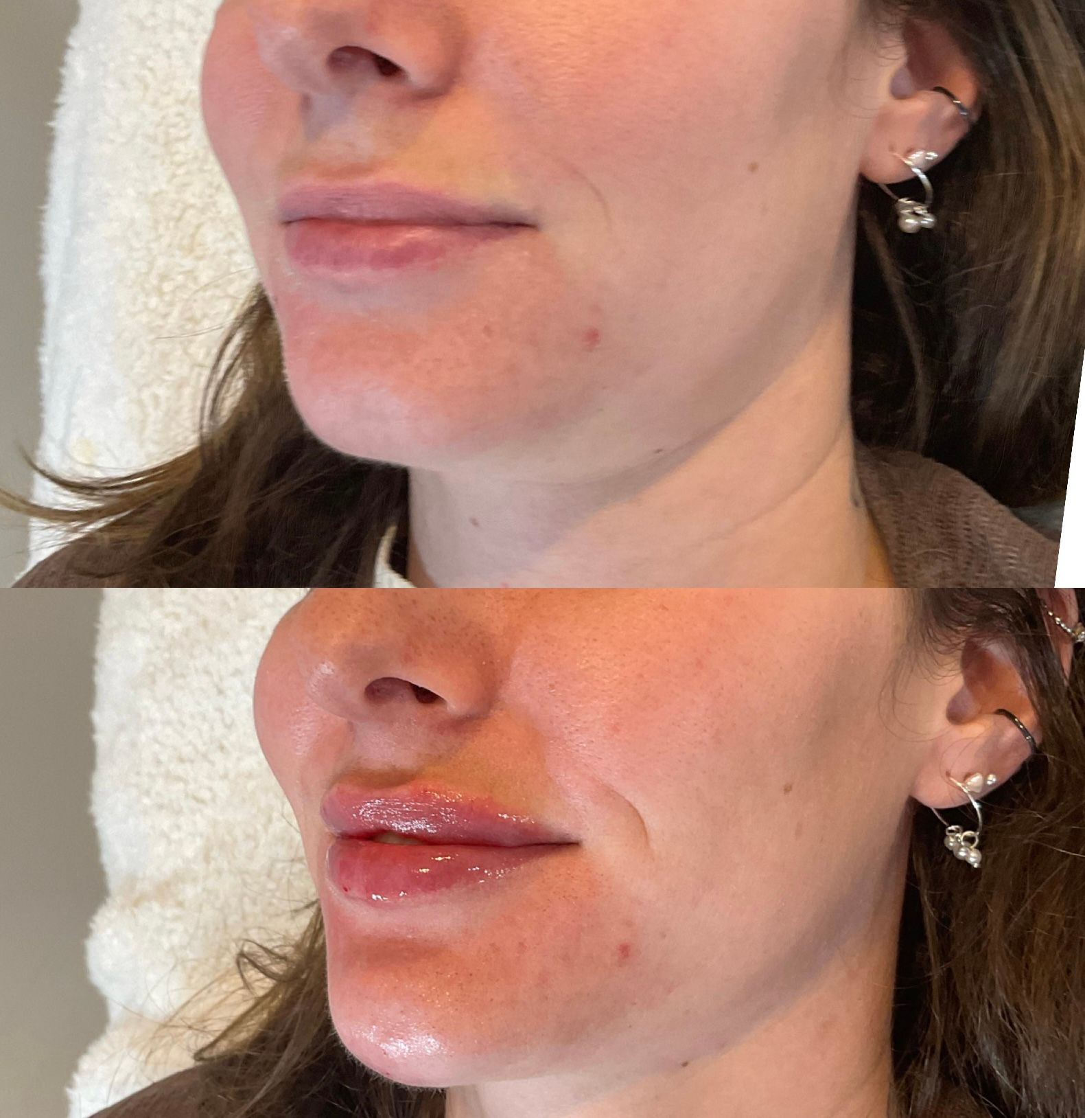 A before and after photo of a woman 's face