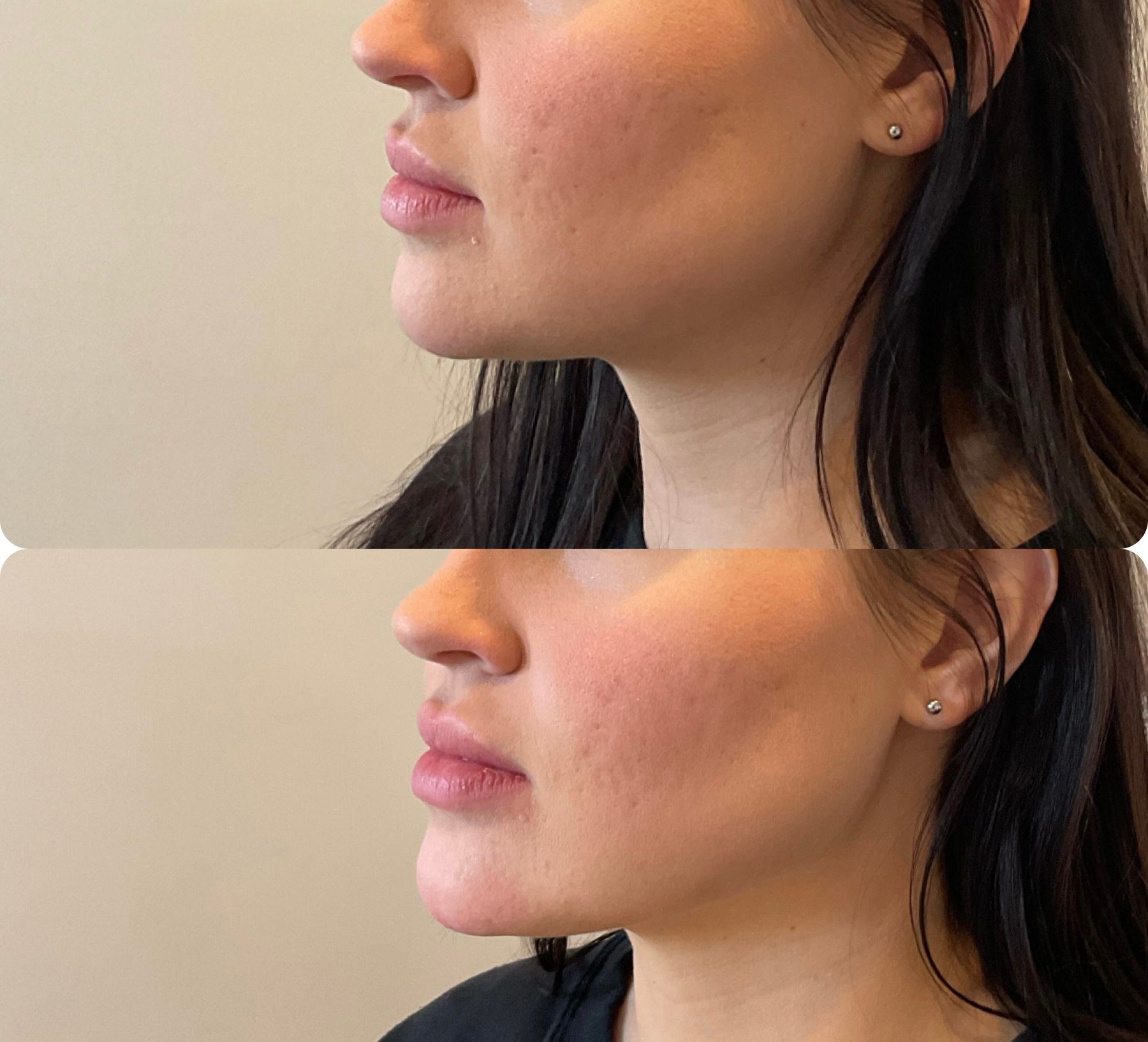 A before and after photo of a woman 's face.