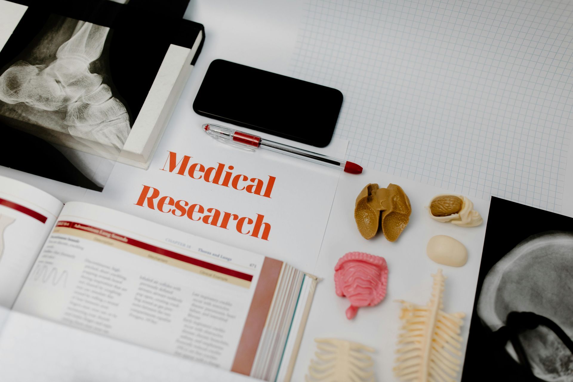 Medical research setup: X-rays, models of body parts, book, pen, and phone on a white surface.