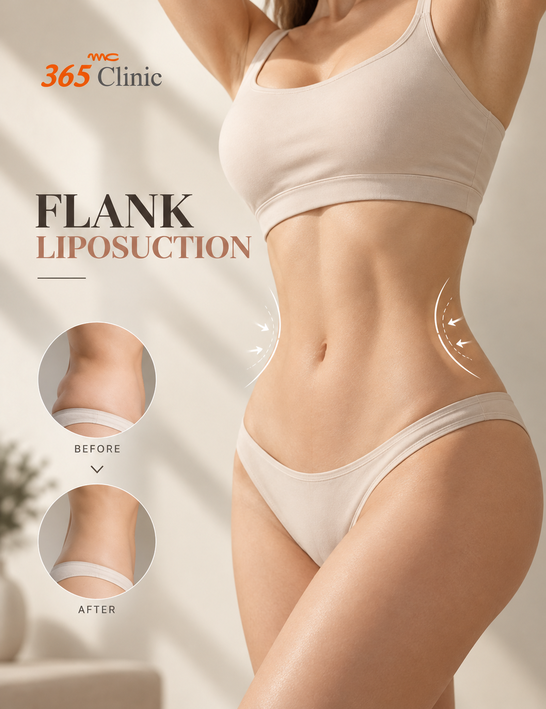 Flank liposuction at 365mc Seoul
