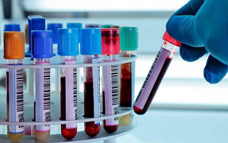 HOSPITAL JUÁREZ - LABORATORIO DE ANÁLISIS CLÍNICOS