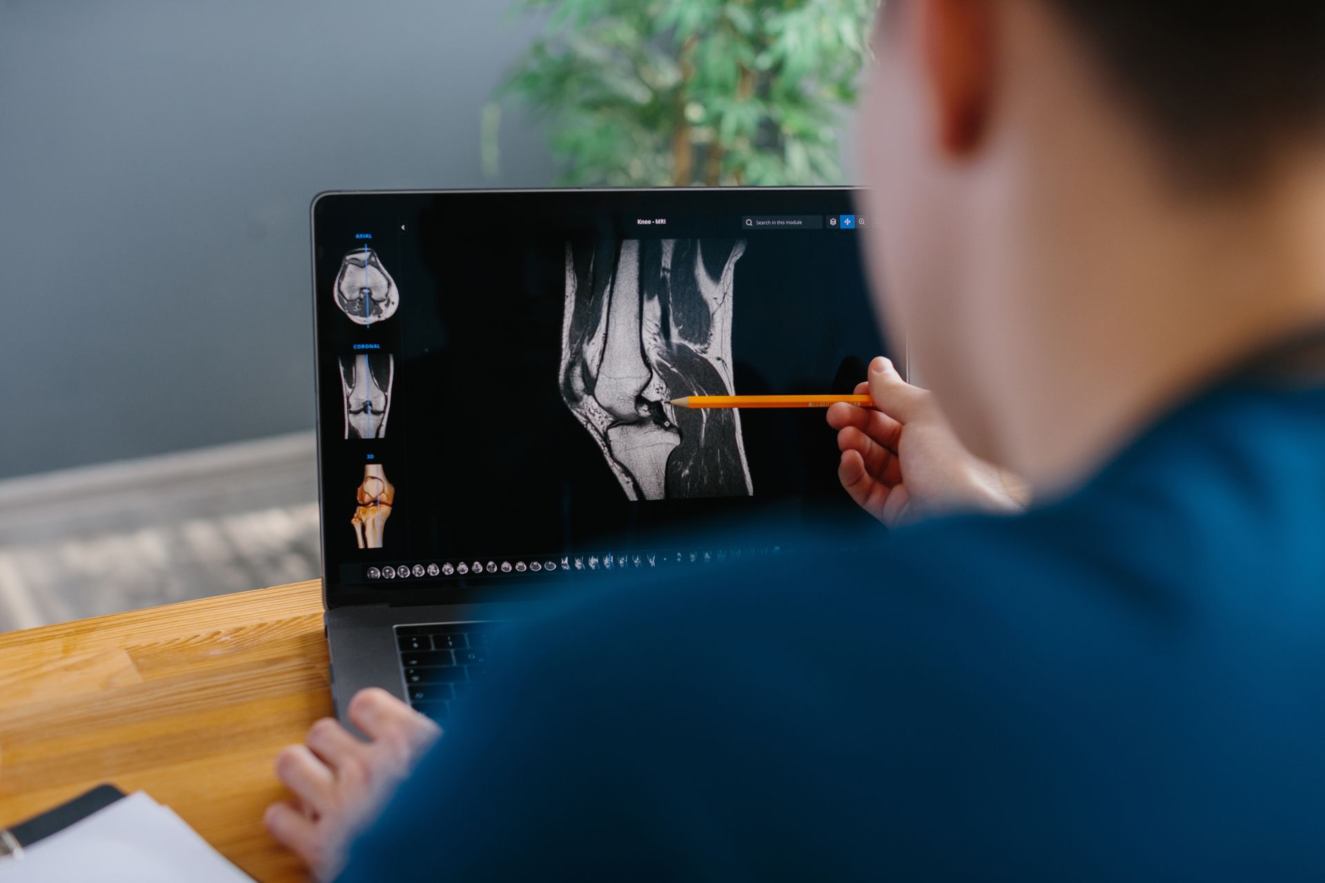 Doctor pointing to a knee MRI scan displayed on a laptop screen during a medical review.