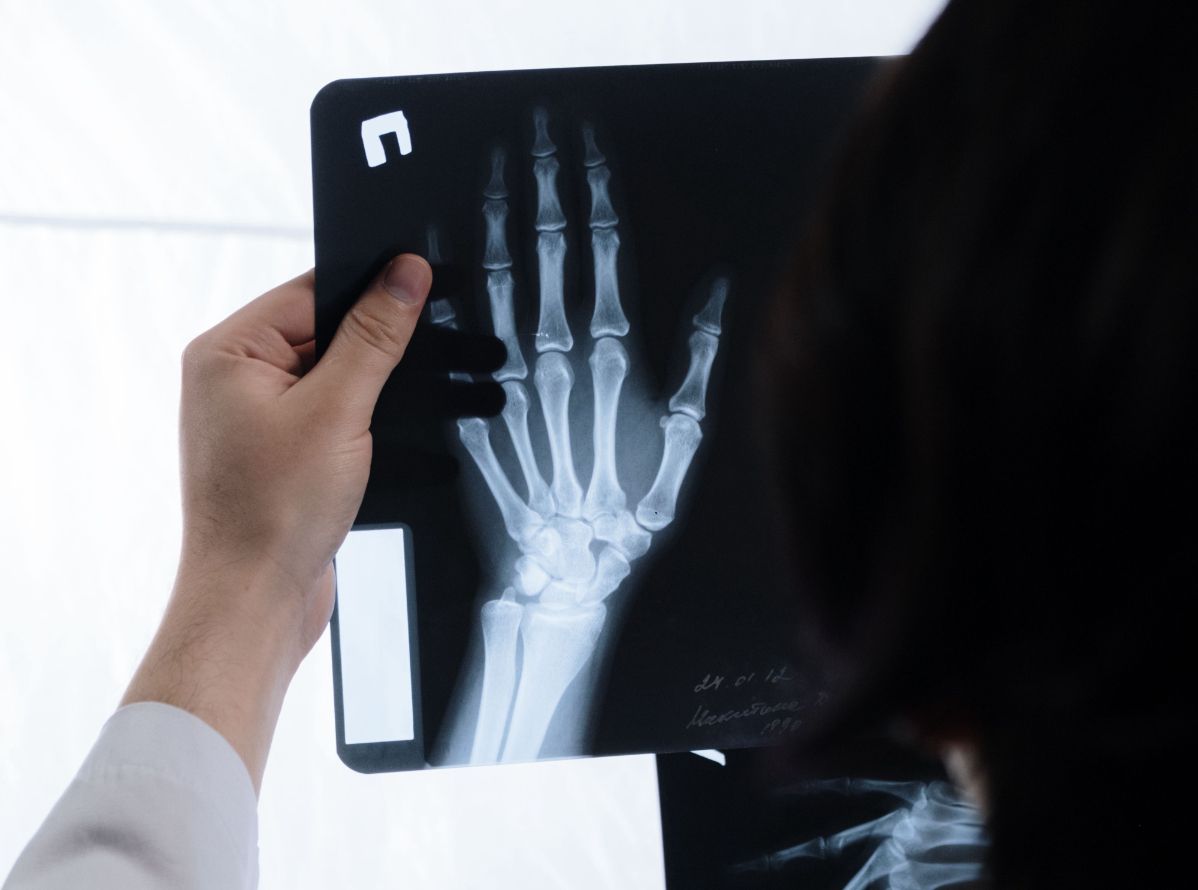 Hand Surgeon Specialist