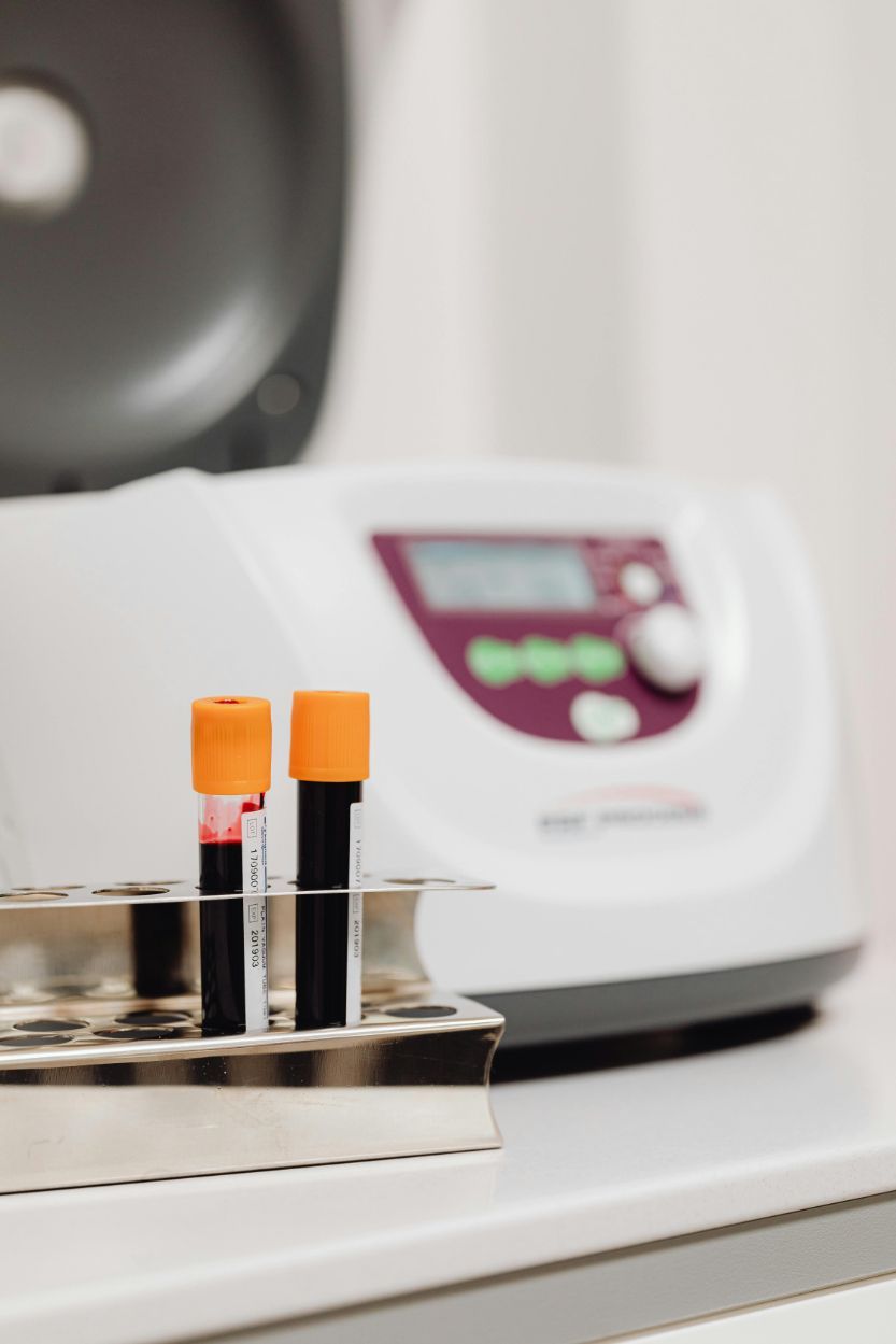 PRP Therapy Near Me