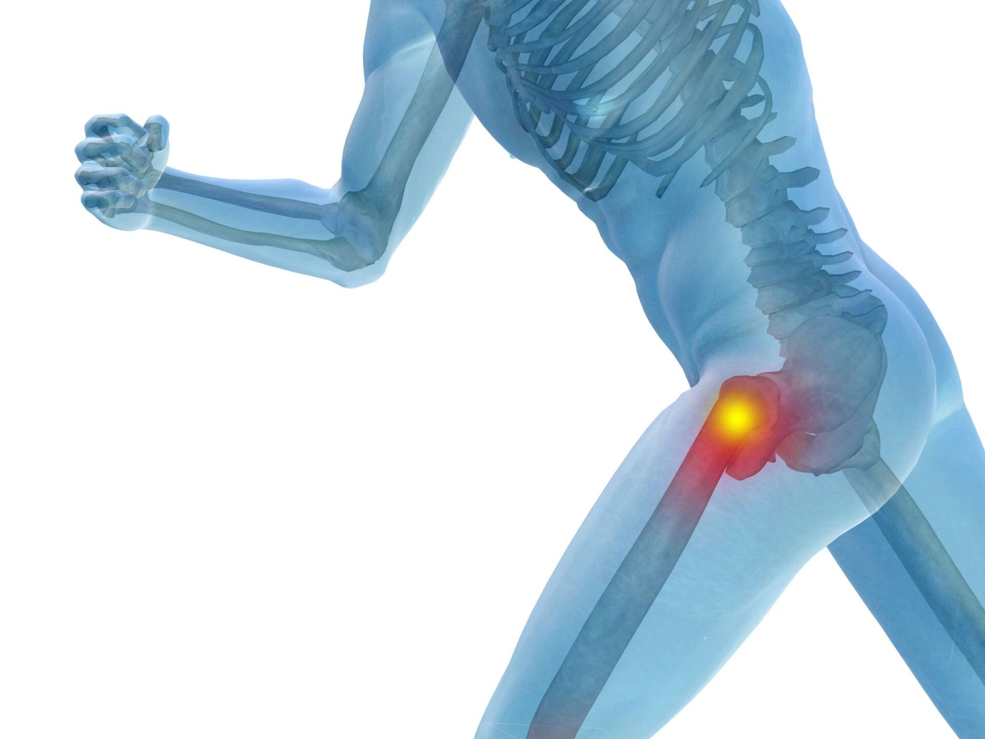 X-ray view of a person running, highlighting pain in hip joint with a red/yellow glow.
