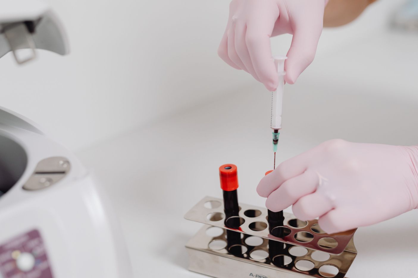 Platelet-Rich Plasma