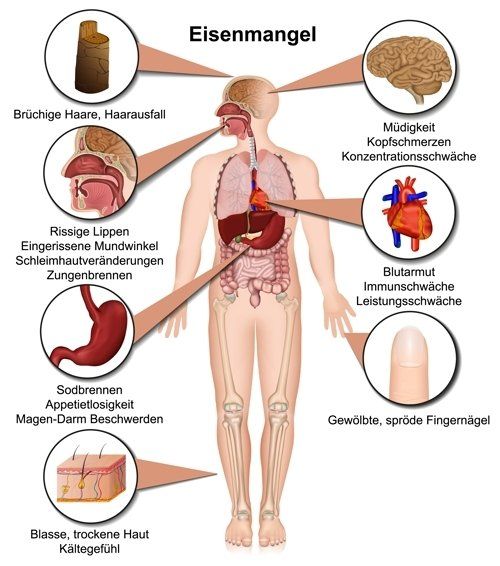 Gesund plus Fit hilft bei Eisen Mangel