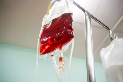 IV blood bag hanging on an IV stand, filled with red fluid, with tubing attached