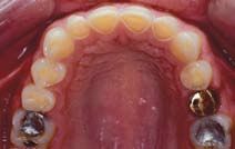 A close up of a person 's mouth with a lot of teeth.