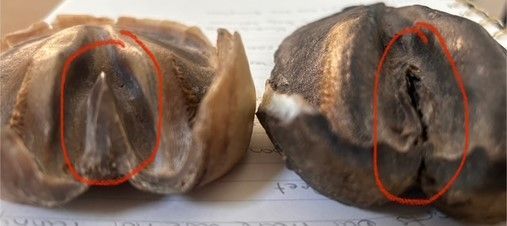 Thrush Infection treatment