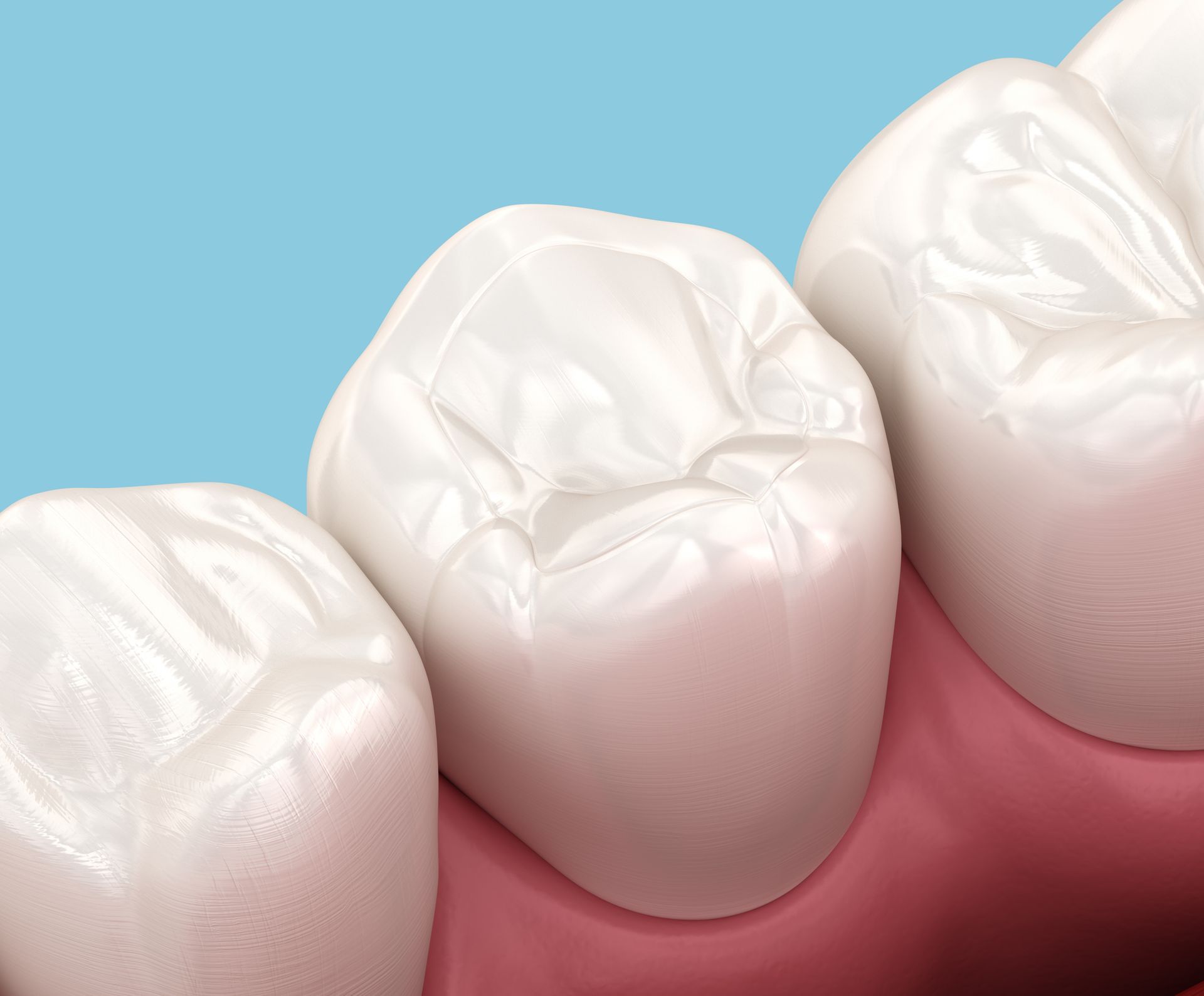 Close-up of three white molars with pink gums