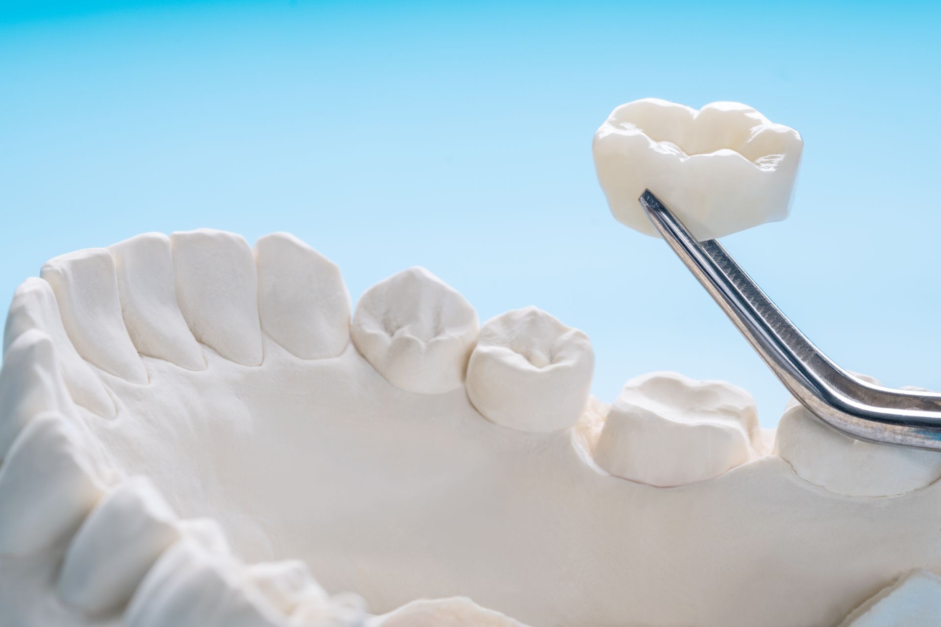 Dental model with white teeth being examined by metal tweezers against a blue background