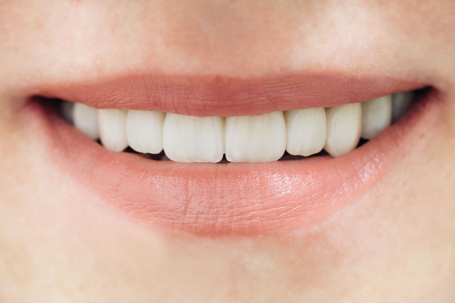 Close-up of a smiling mouth with white teeth and pink lips