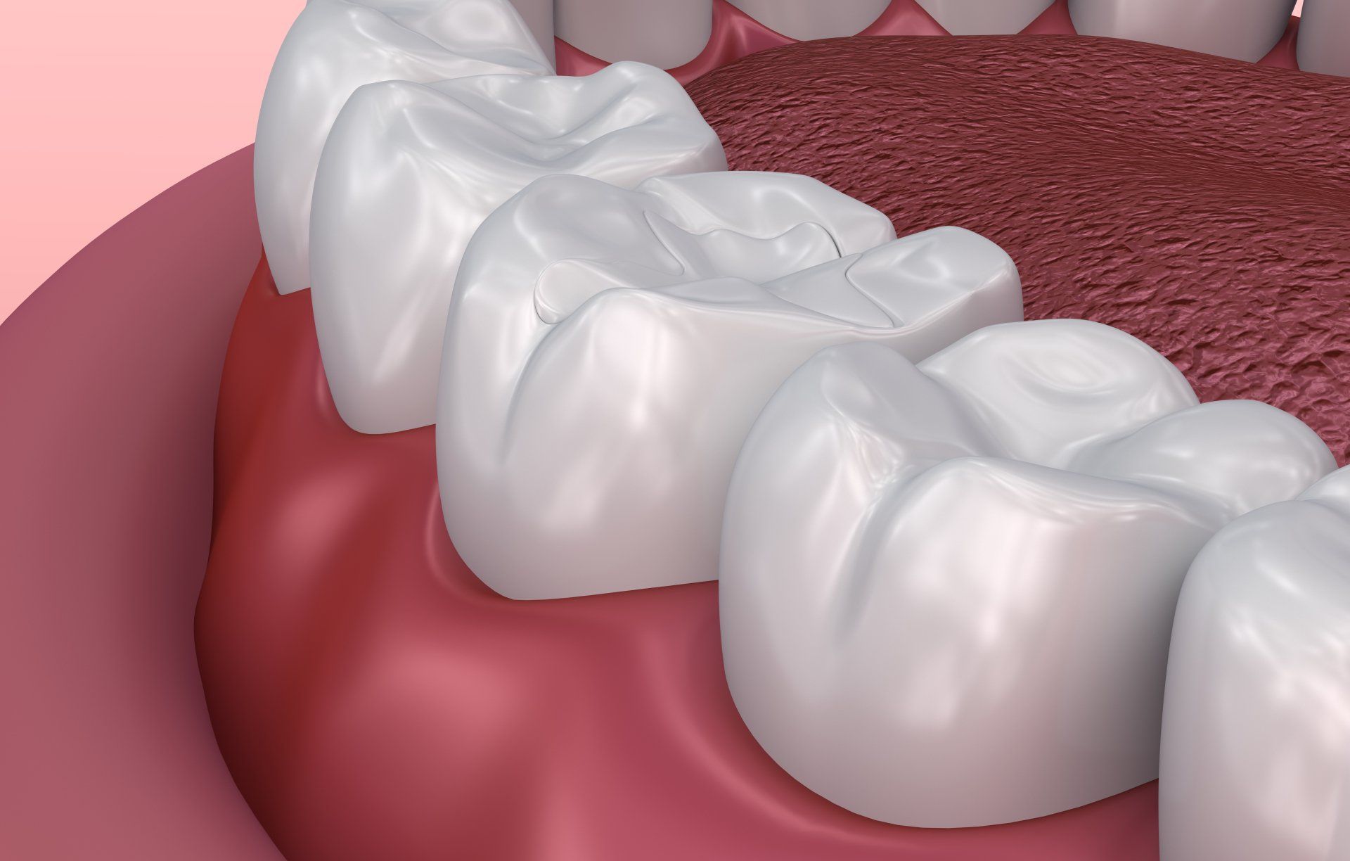 Close-up of molars and pink gums, showing healthy teeth along the side of a mouth.