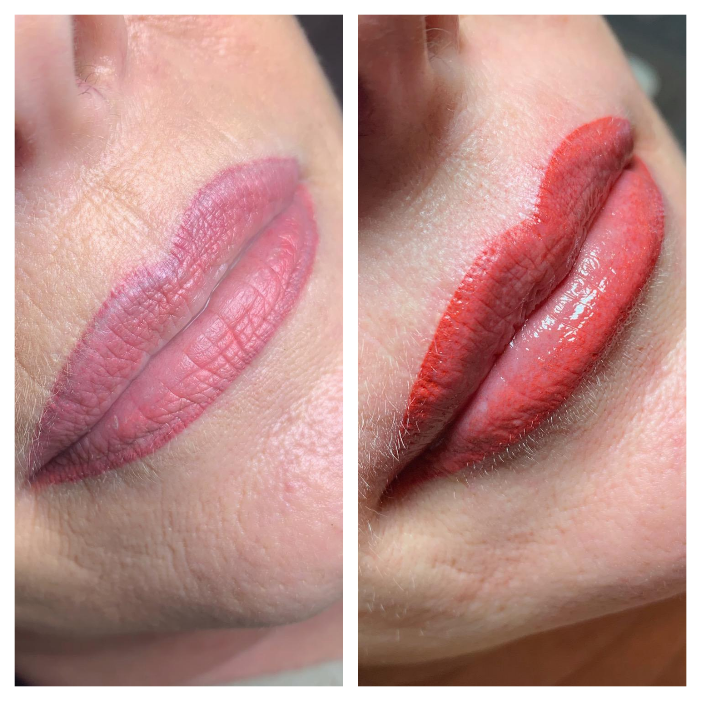 Ein Vorher-Nachher-Foto der Lippen einer Frau.