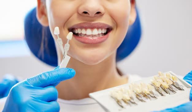 How much do veneers cost in Columbus