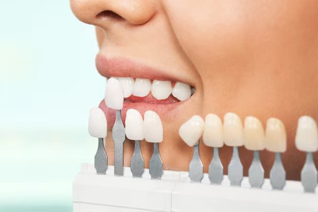 veneers dentist in Columbus