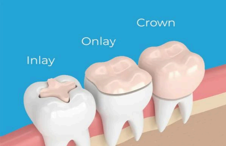 Crown