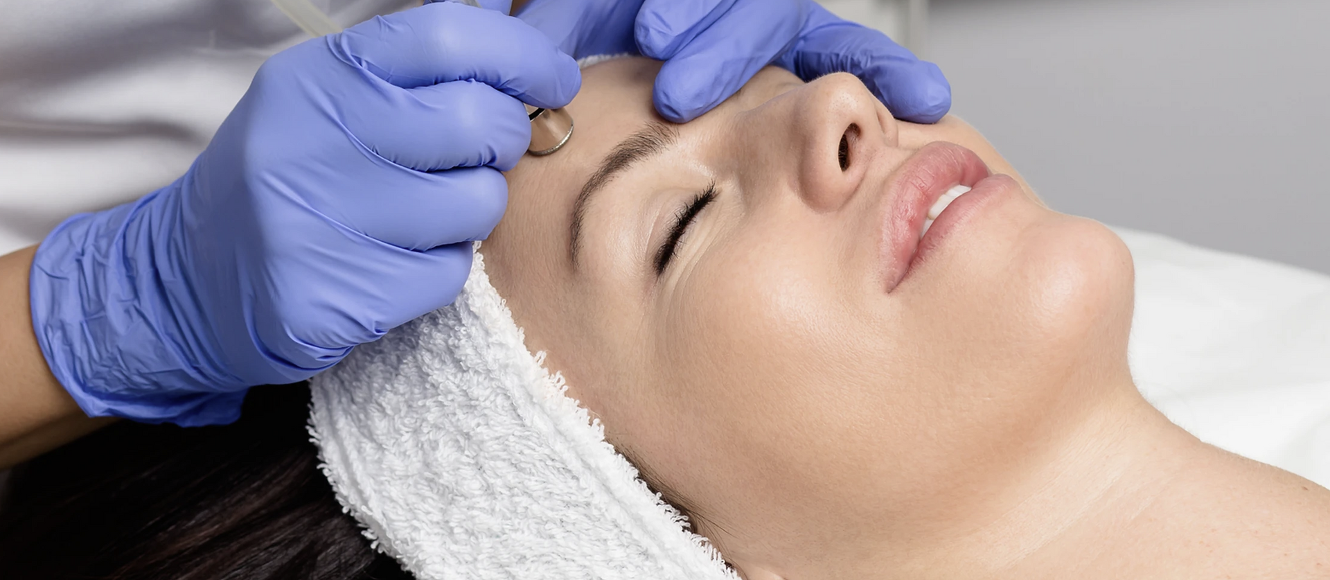 Thread Lift Recovery Process at Rebecca Skinner blog
