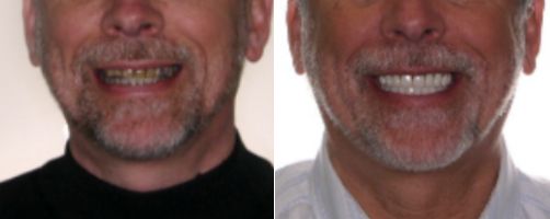 Before & After Photo