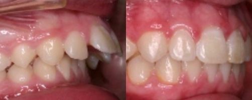 Before & After Photo