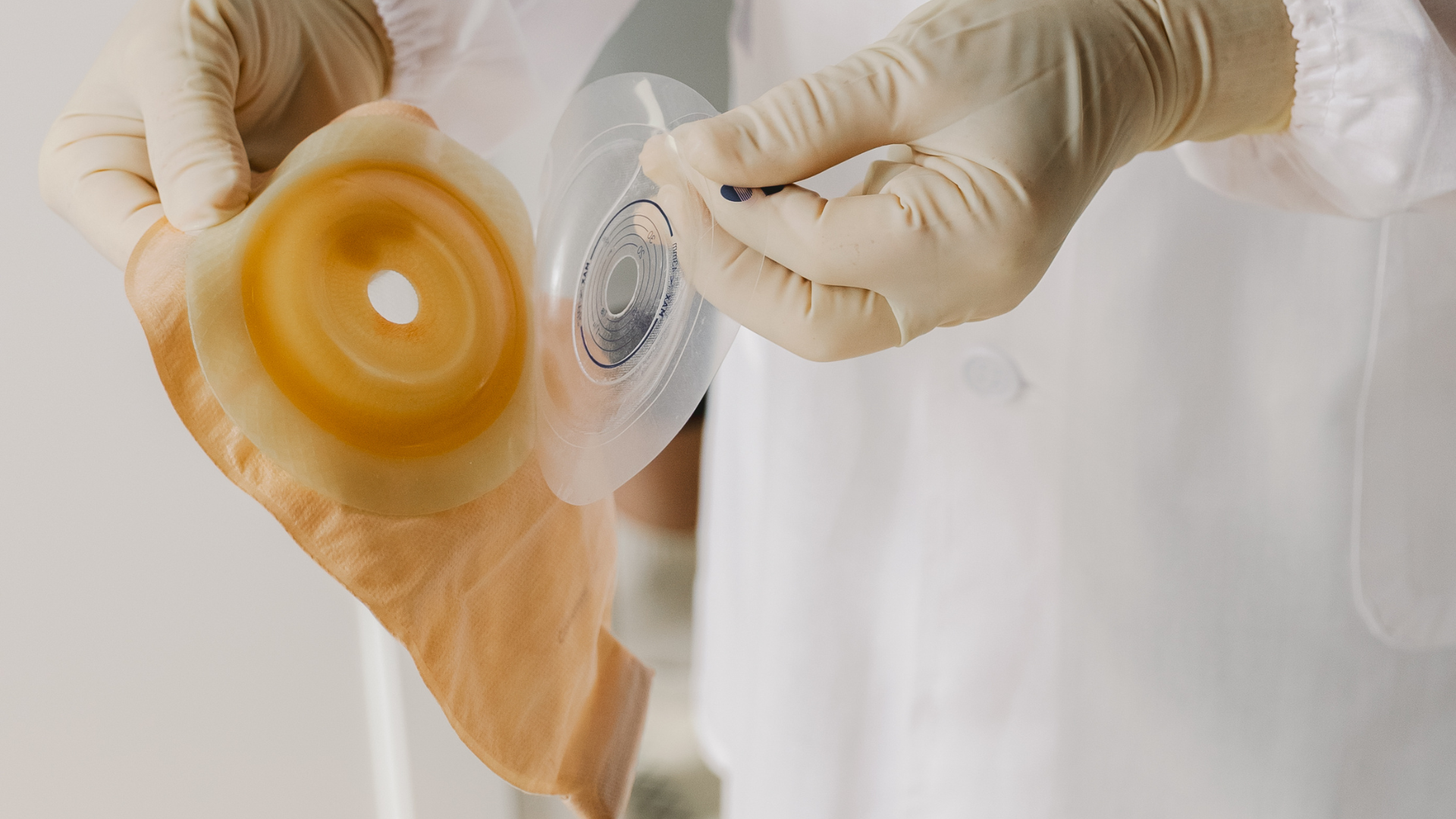 Gloved hands holding an ostomy pouch and wafer, medical setting.