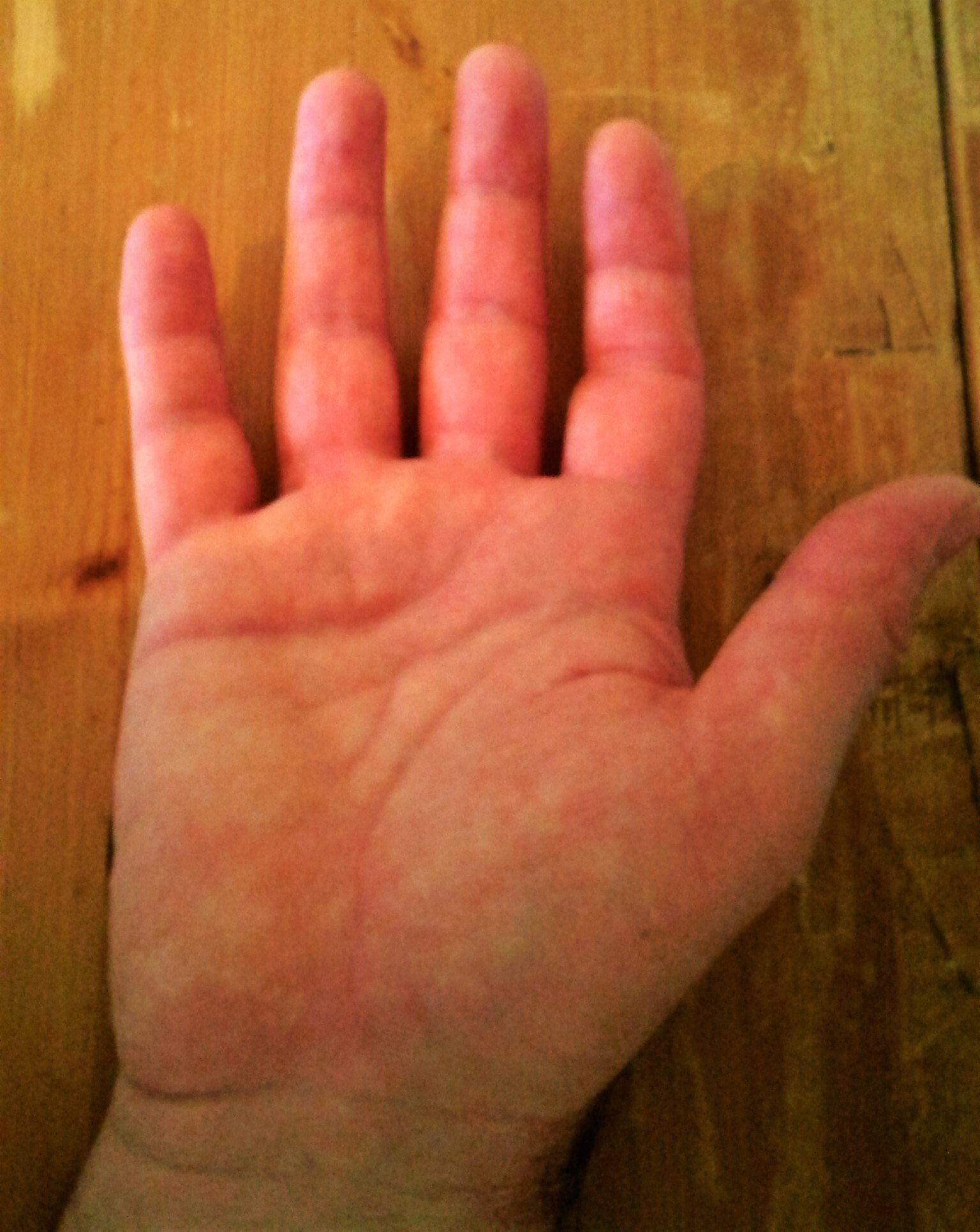 palm photo