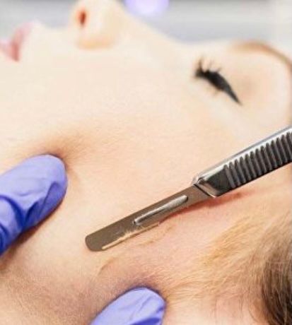 A woman is getting her face waxed with a scalpel.