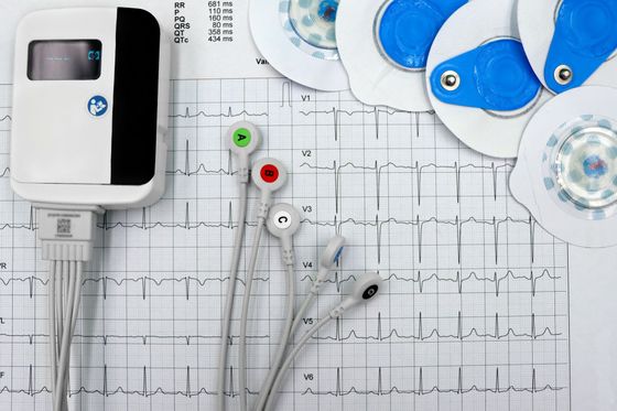 A heart monitor is sitting on top of an ecg chart.